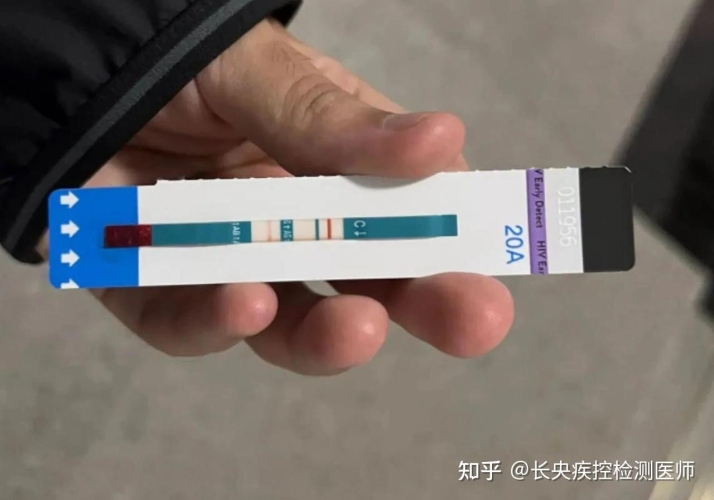艾滋病检测全攻略，多久能查出来？艾滋病多久能查出来抽血