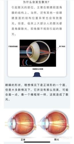 这种动作其实是在伤害眼睛，你不知道的日常护眼误区这种动作其实是在伤害眼睛吗
